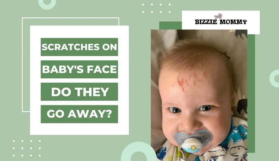 scratches on baby's face