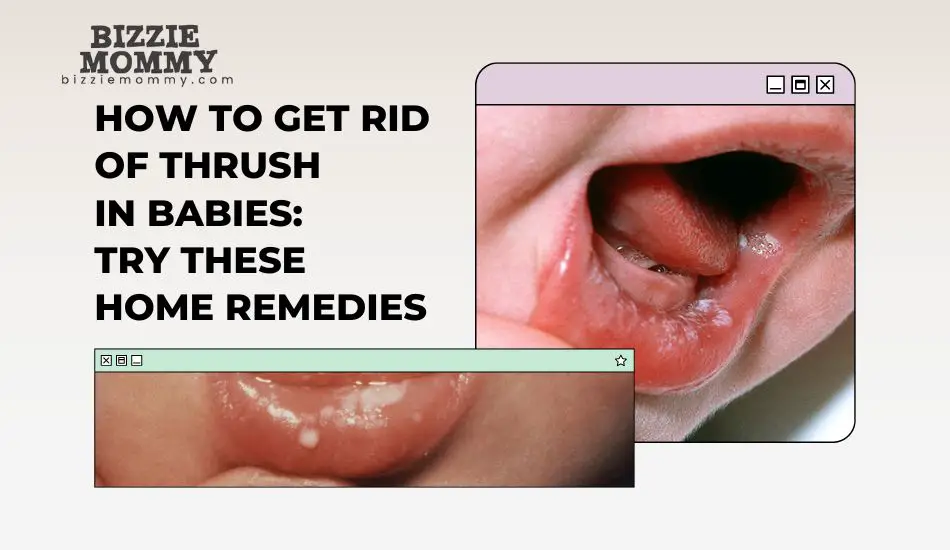 how to get rid of thrush in babies